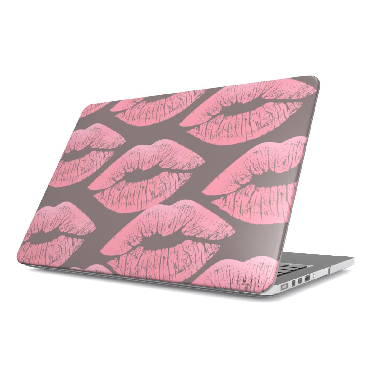 Print On Demand MacBook Case-Tech Accessories-Dalge