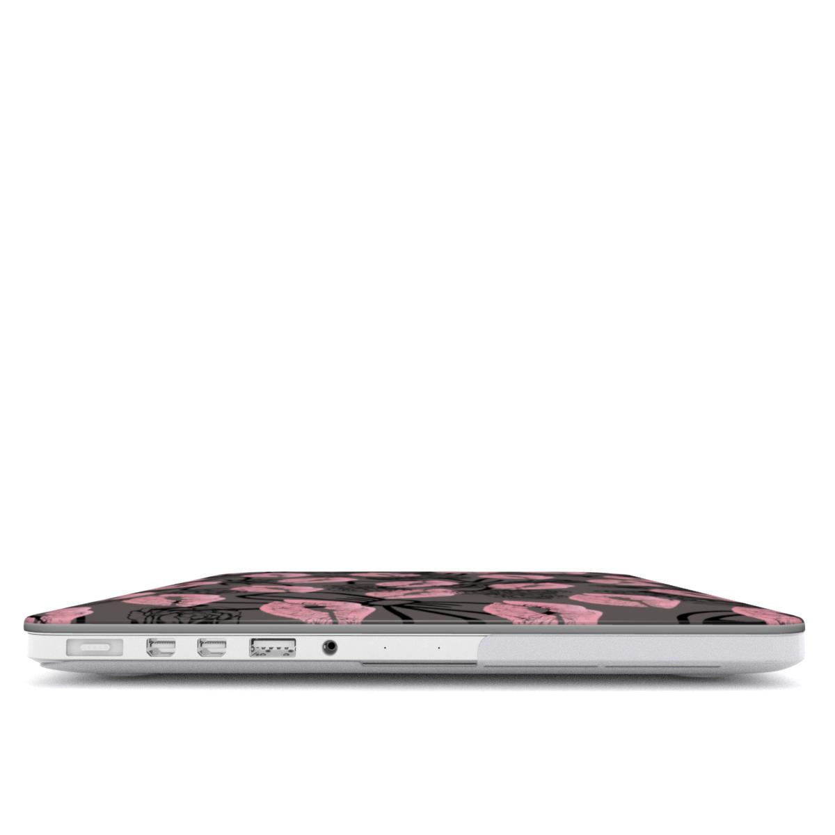 Dark Dream 2 MacBook Case-Tech Accessories-Dalge