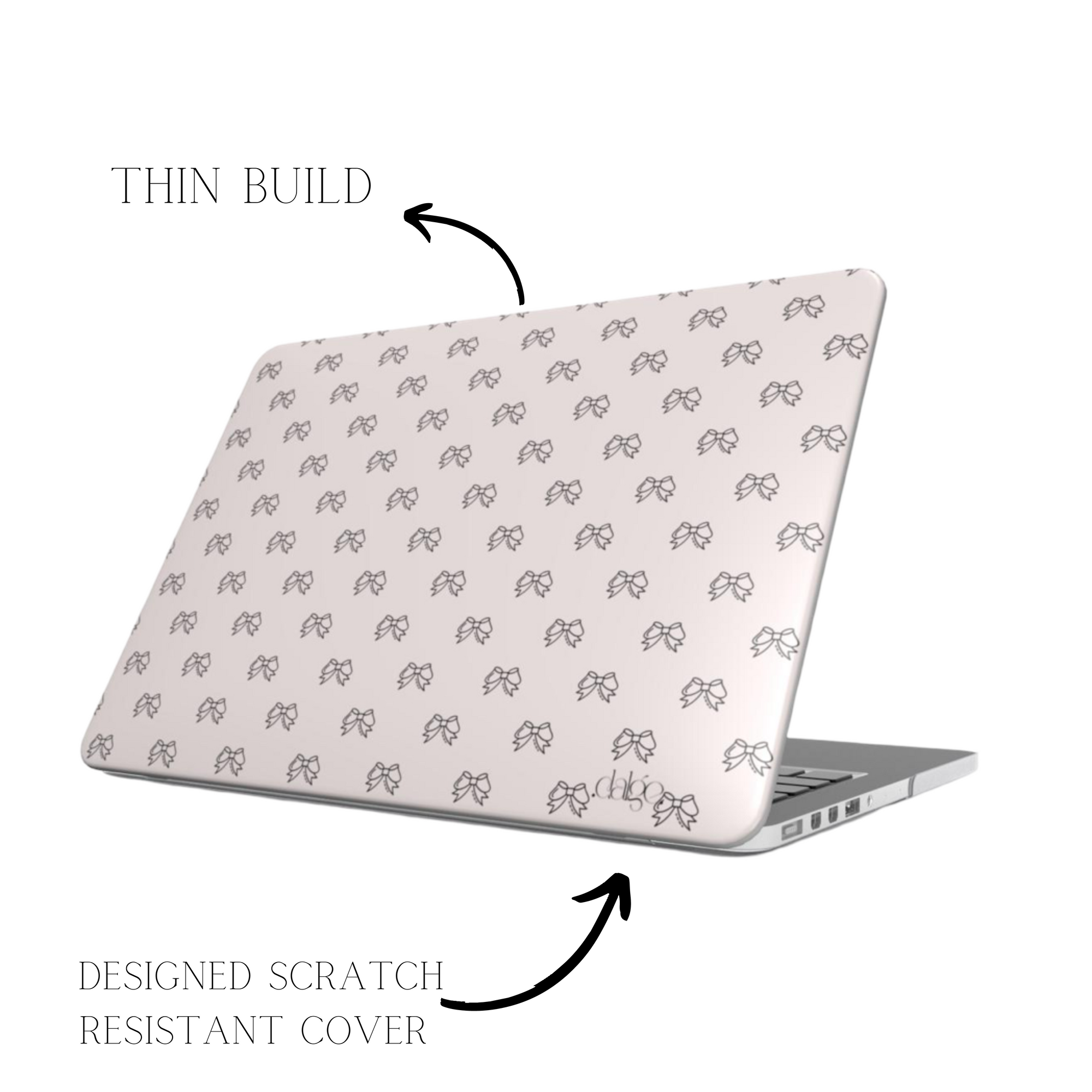 Pretty Bows Laptop Case